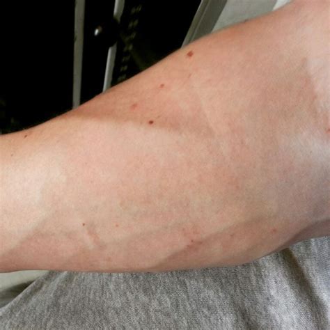The Veins In My Arm After The Workout The Other Day Swolfie