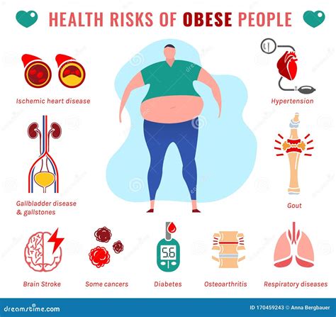 Fat People Diseases Stock Illustration Illustration Of Gain