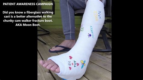 Walking Boot Vs Cast Orthopedic Cam Boot For Broken Boot Comparing