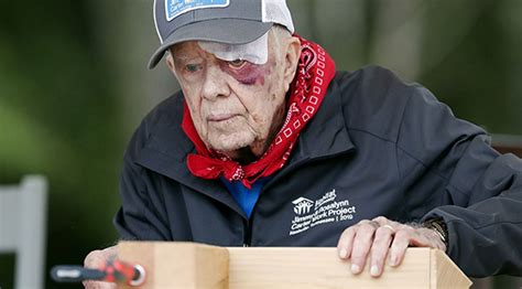 Despite 14 Stitches And A Black Eye Jimmy Carter Helps Build Habitat For Humanity Homes In