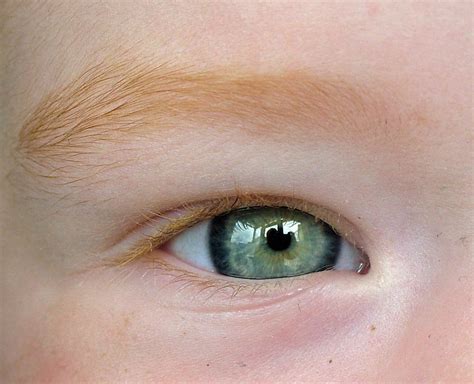 Green Eyes Irish Eyes At 22 Months Bernard Goldbach Flickr