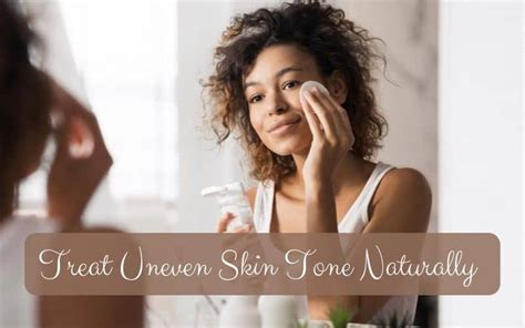 Heres How You Can Cure Uneven Skin Tone All By Yourself