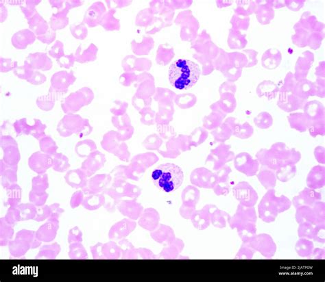 Human Blood Smear With Neutrophils Light Micrograph Stock Photo Alamy
