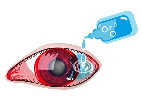 Viral Eye Infection Types Symptoms Treatment Stdgov Blog