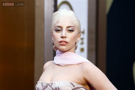 Should Gaga Put Her Face Back To Normal Prior To 2012 Page 3