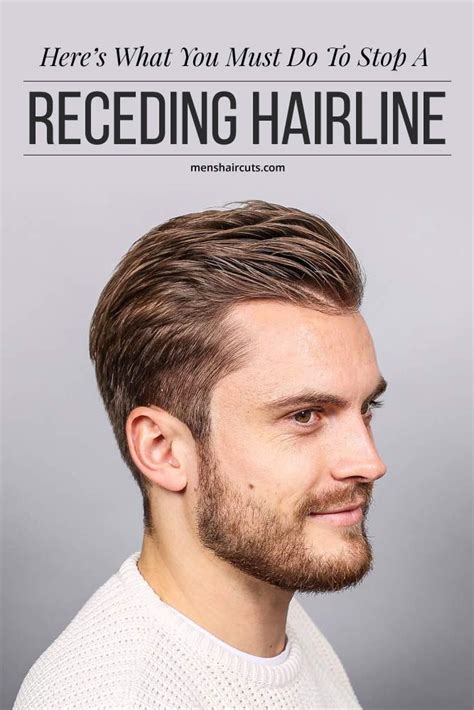 Here’s What You Must Do To Stop A Receding Hairline ★ Long Hair Receding Hairline Mens Haircuts