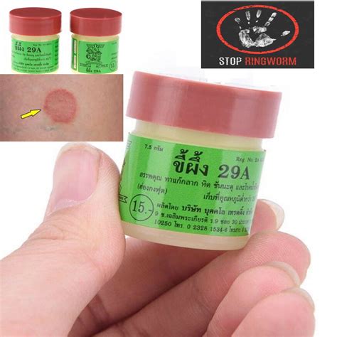 Buy Ringworm Treatment Herbal And Natural Ointment Relieves Itching