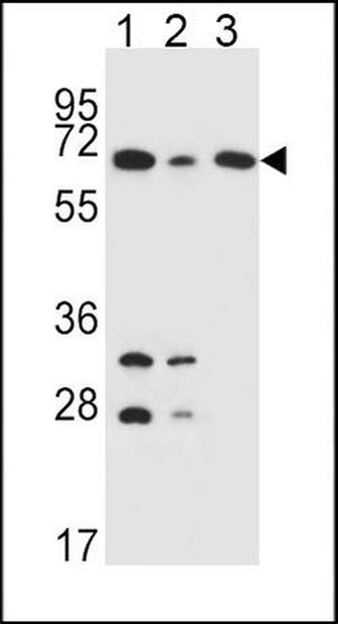 Dlat Polyclonal Antibody Pa5 25260