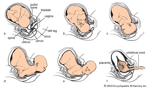 Fetal Delivery Positions