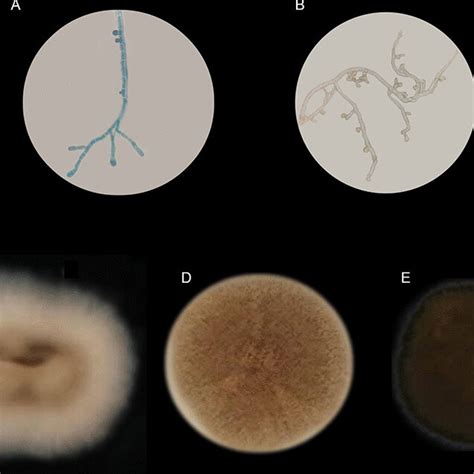 Morphology Of Filamentous Fungus A Mycelium Stained With Lactophenol