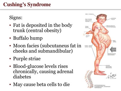 Ppt Endocrine Physiology The Adrenal Gland 2 Powerpoint Presentation