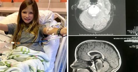 11 Year Old Girls Brain Tumor Miraculously Disappears