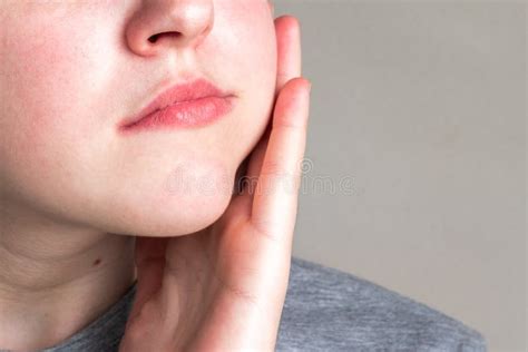 Cheek Swollen Causes Symptoms Treatments