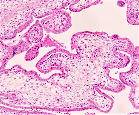 Pathology Outlines Anatomy And Histology Placenta And Umbilical Cord