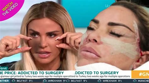 Katie Prices Risks Health With Plans For Even More Bizarre Plastic Surgery Irish Mirror Online