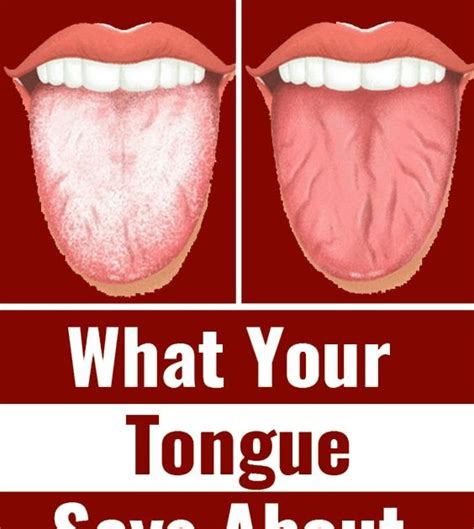 What Your Tongue Says About Your Health Wellness Topic