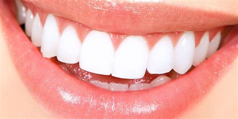 Teeth Whitening For A Beautiful Smile