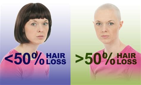 How Soon After Chemotherapy Hair Loss Hair Regrowth After Cancer And Why I Ditched The Wigs