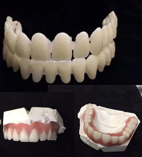 Instead of being a smart solution to a big. Do It Yourself Denture Kit Make Your Own Temporary image 1 ...