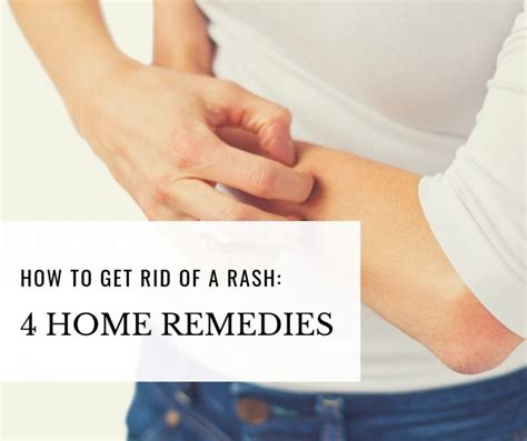 How To Get Rid Of A Rash 4 Home Remedies Healthy Habits