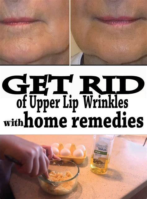 Get Rid Of Upper Lip Wrinkles With Home Remedies Wiki Remedies
