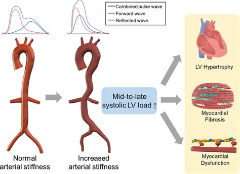 Cardiac Consequence Of Increased Arterial Stiffness In Individuals Download Scientific Diagram