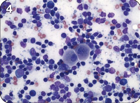 Lymph Node Cytology What Should And Should Not Be There
