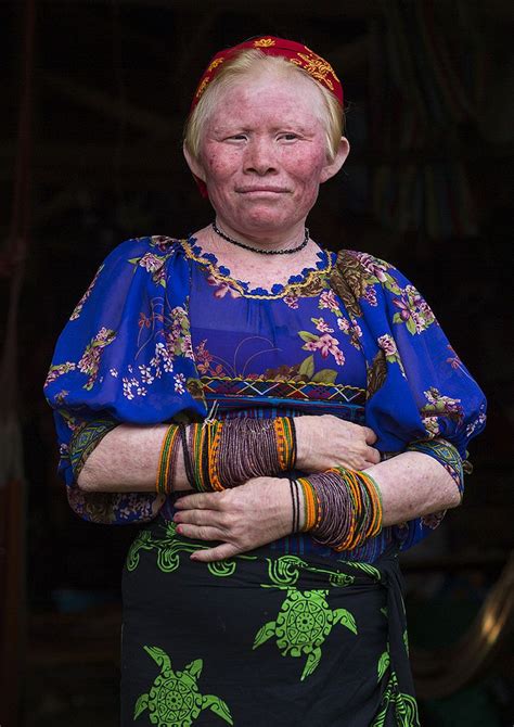 Portrait Of An Albino Kuna Tribe Woman From San Blas Islands Panama