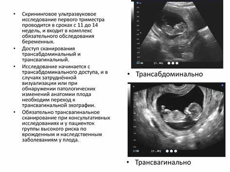 Можно ли похудеть в первом триместре беременности