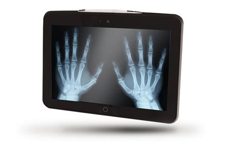 X Ray Png Hd Quality Png Play