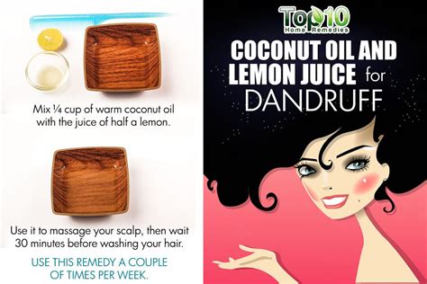 Dandruff is an internal problem. 10 Inexpensive Beauty Remedies Every Girl Should Know - Page 3 of 3 | Top 10 Home Remedies