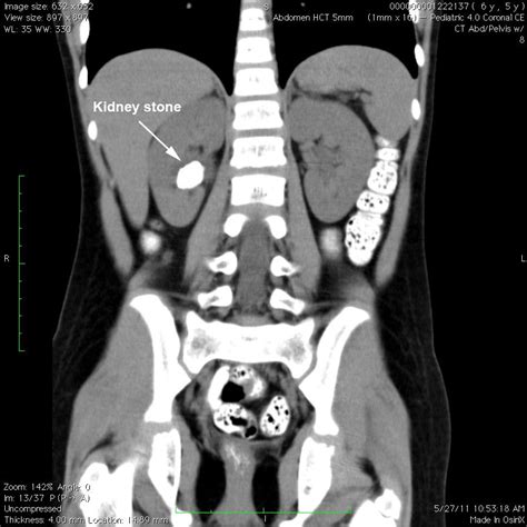 Computed Tomography Ct Or Cat Scan Is A Noninvasive Diagnostic