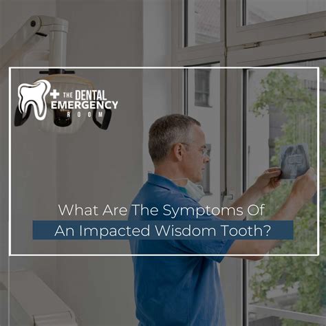 What Are The Symptoms Of An Impacted Wisdom Tooth
