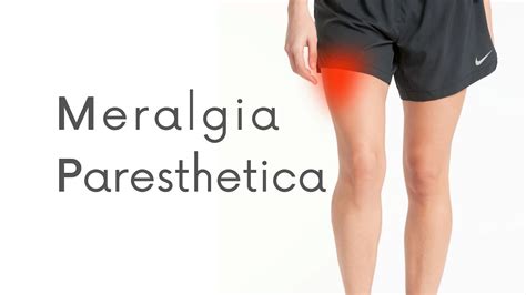 Meralgia Paresthetica Physical Therapy Techniques Examples