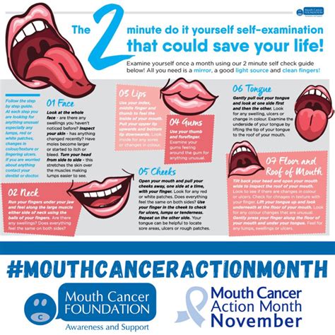 Mouth Cancer Facts And Figures Mouth Cancer Foundation