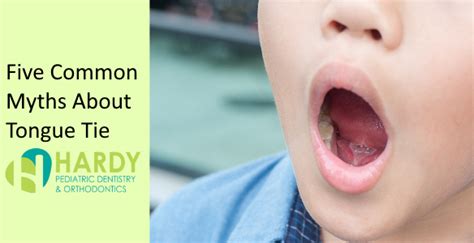 Five Common Myths About Tongue Lip Ties Hardy Pediatric Dentistry