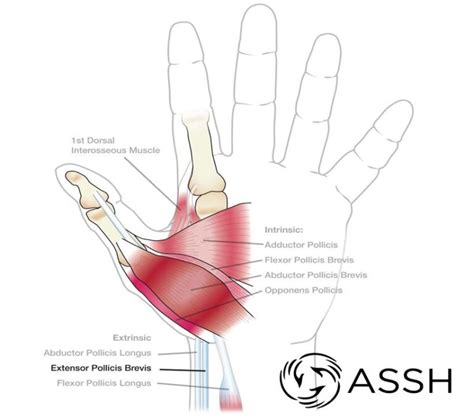 Muscles Of The Upper Extremities Teton Hand Surgery