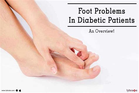 Foot Problems In Diabetic Patients An Overview By Dr Milind Ruke