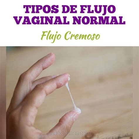 Teleférico Cascada Posesión Flujo Vaginal Blanco Antes De La Regla Detección Disponible Estafa