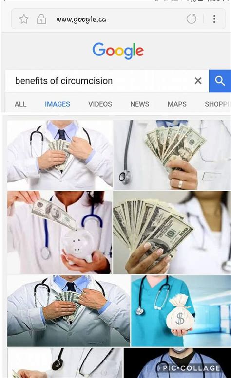 Benefits Of Circumcision Circumcision Video News Benefit