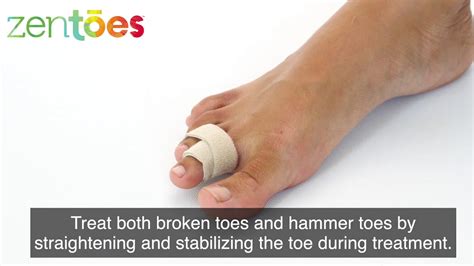 Zentoes Broken Toe Wraps Cushioned Bandages Hammer Toe Separator