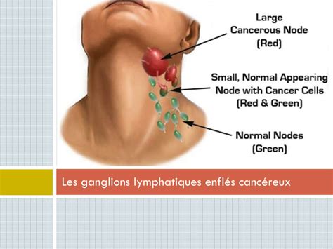 PPT Le système lymphatique PowerPoint Presentation free download ID