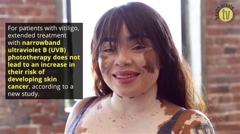 Skin Cancer Risk For Patients With Vitiligo Does Not Increase After Uvb