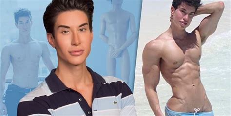 Justin Jedlica The Human Ken Doll Wants To Undergo Plastic Surgery To Have His Forehead Veins