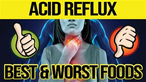 Best And Worst Foods For Acid Reflux Youtube
