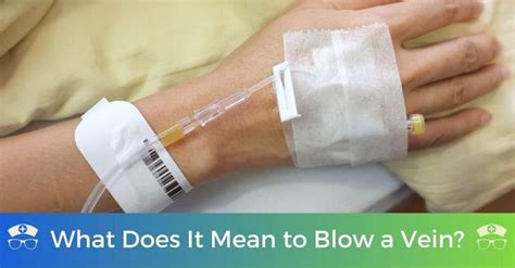 What Does It Mean To Blow A Vein Veins Blow Phlebotomy