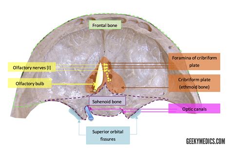 Cranial Foramina Skull Anatomy Foramen Geeky Medics