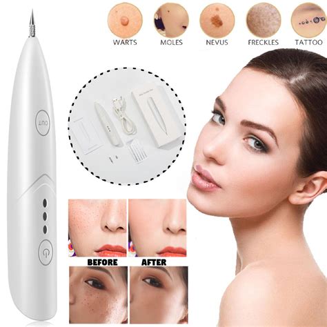 usb lcd electric freckle remove pen mole tag dark spots tattoo wart removal beauty machine