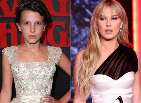 Millie Bobby Brown Before And After Plastic Surgery