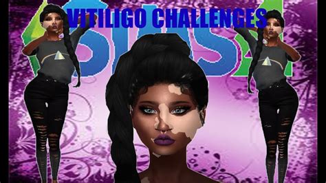 ~ Sims 4 ~ Create A Sims Vitiligo Challenge Youtube